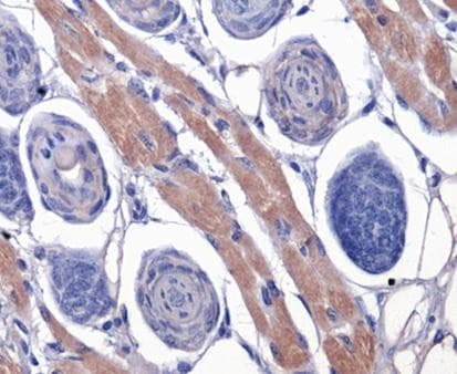 F2R / Thrombin Receptor / PAR1 Antibody (clone N2-11, DY488)
