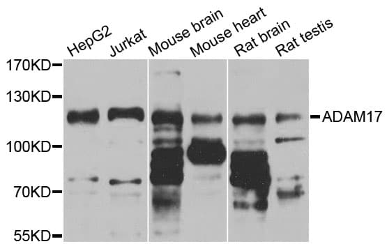 Polyclonal Rabbit anti-Human ADAM17 / TACE Antibody (IHC, WB)