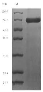 Mouse TMPRSS15 / Enterokinase Protein (Recombinant 6His-SUMO, N-terminus)