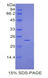 Rat CASP9 / Caspase 9 Protein (Recombinant His)