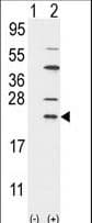 UBCH10 / UBE2C Antibody (aa10-39)
