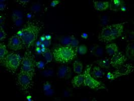 ATP5B / ATP Synthase Beta Antibody (clone OTI4E5)