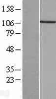 PPP4R1 / PP4R1 Protein (Over-Expression Lysate Myc-DDK (Flag))