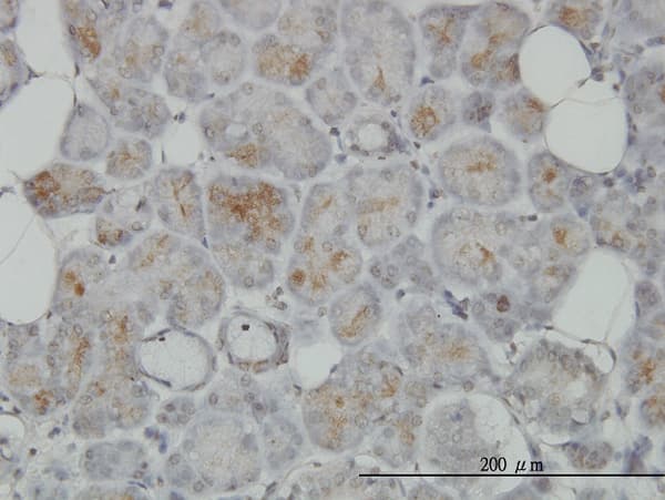 TRIM35 Antibody (clone 4F7)