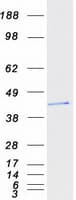 Human TICAM2 / TRAM Protein (Recombinant Myc-DDK (Flag))