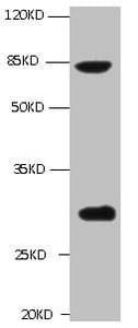 TGM2 / Transglutaminase 2 Antibody (clone 3H2B8)