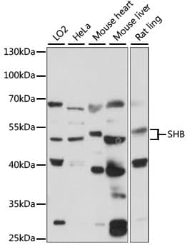 Polyclonal Rabbit anti-Human SHB Antibody (WB)