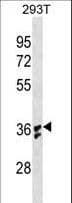 IL-1B / IL-1 Beta Antibody (aa148-174)