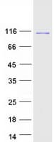 Human KIF11 / EG5 Protein (Recombinant Myc-DDK (Flag))