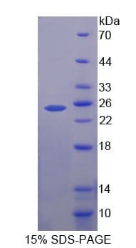 Dog GH / Growth Hormone Protein (Recombinant His-T7)