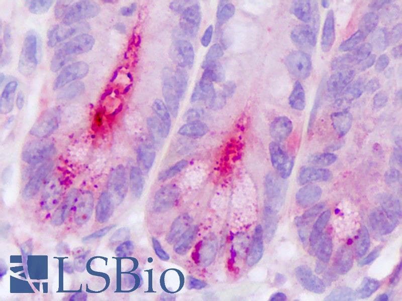 IHC-plus™ Polyclonal Rabbit anti-Human DPP4 / CD26 Antibody (Internal, IHC)