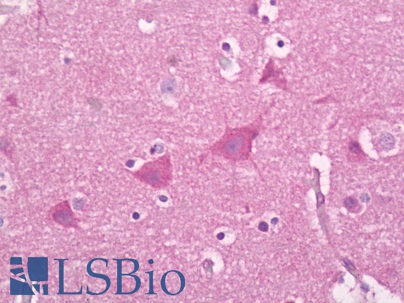 IHC-plus™ Synaptotagmin Antibody (aa276-325)