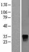 DUSP4 / MKP2 Protein (Over-Expression Lysate Myc-DDK (Flag))