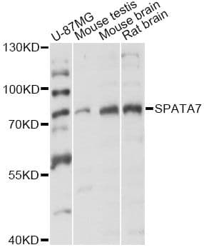 LCA3 / SPATA7 Antibody