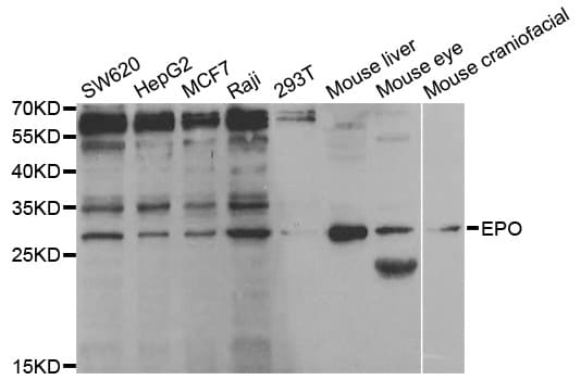 EPO / Erythropoietin Antibody