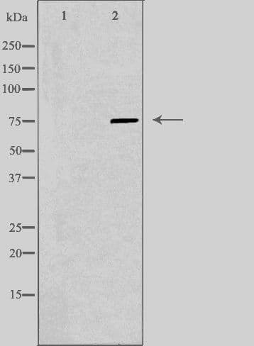 Polyclonal Rabbit anti-Human AMPH / Amphiphysin Antibody (IF, WB)