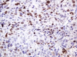 MKI67 / Ki67 Antibody (clone OTI9H7)
