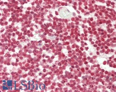 IHC-plus™ PHF6 Antibody (aa125-175)