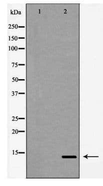 Polyclonal Rabbit anti-Human SNCB / Beta-Synuclein Antibody (IHC, IF, WB)
