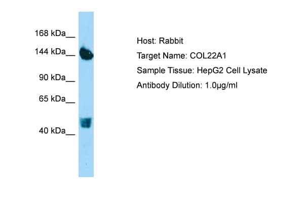 COL22A1 / Collagen XXII Antibody (aa254-303)