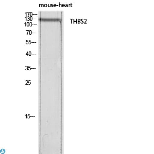 THBS2 / Thrombospondin 2 Antibody
