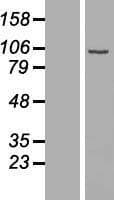 C1orf107 / DEF Protein (Over-Expression Lysate Myc-DDK (Flag))