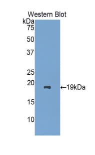CRBPIV / RBP7 Antibody (aa1-134)