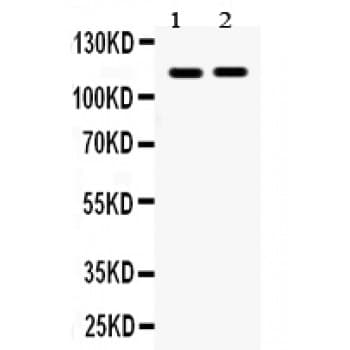 EPHA5 / EPH Receptor A5 Antibody (aa1001-1032)