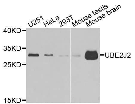 UBC6 / UBE2J2 Antibody