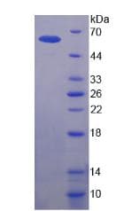 Human ABCB1 / MDR1 / P Glycoprotein (Recombinant His-GST, N-terminus)