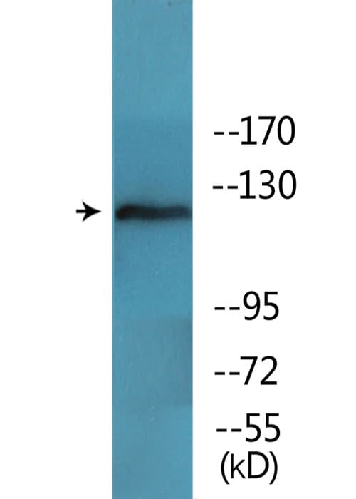 Polyclonal Rabbit anti-Human FAK / Focal Adhesion Kinase Antibody (phospho-Tyr397, IHC, WB)