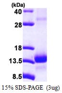 Human TCEB1 / Elongin C Protein (Recombinant His)