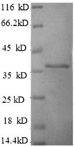 Human HLA-G Protein (Recombinant 6His, N-terminus)
