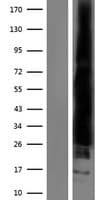 Human RAC2 Protein (Over-Expression Lysate Myc-DDK (Flag))