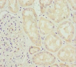 INPP5K / SKIP Antibody