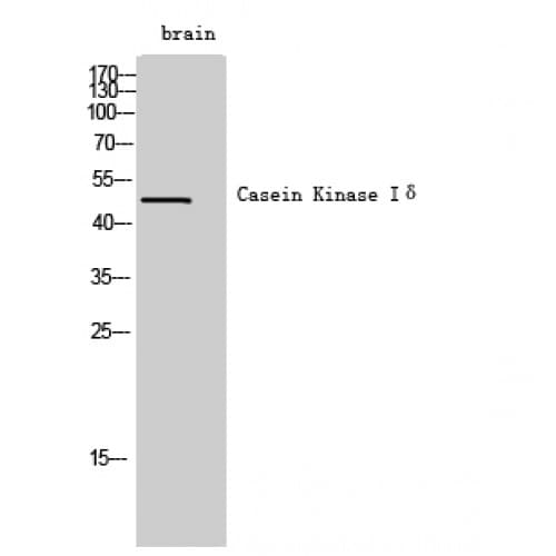 CSNK1D Antibody (260-340 aa, Internal)