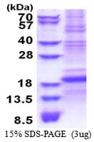Human CD8B / CD8 Beta Protein (Recombinant His)