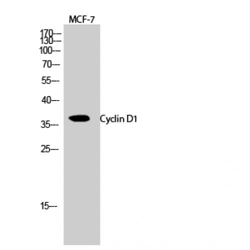 CCND1 / Cyclin D1 Antibody (220-300 aa)