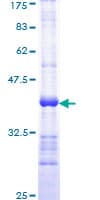 Human TRADD Protein (Recombinant GST, N-terminus)