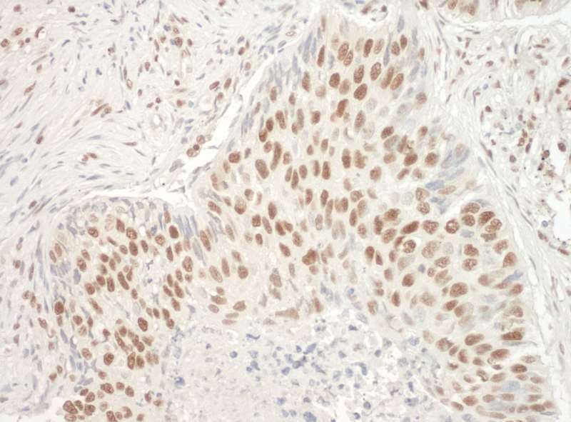 ALY / THOC4 Antibody (aa25-75)
