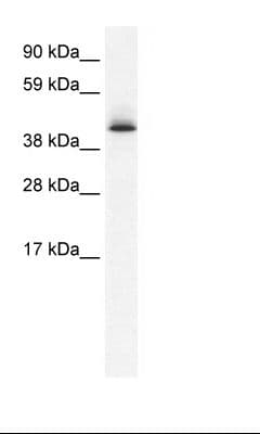 AATF Antibody (aa171-220)