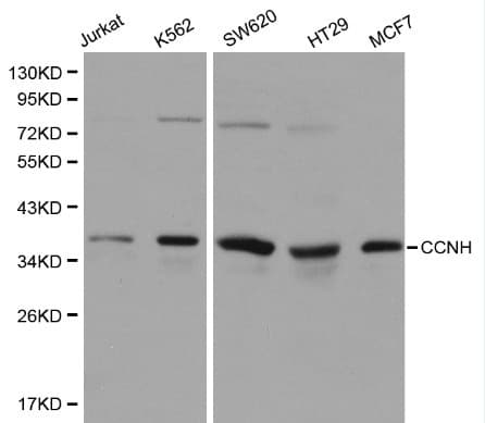 Polyclonal Rabbit anti-Human CCNH / Cyclin H Antibody (IHC, WB)