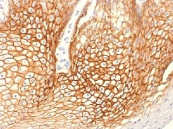 JUP/CTNNG/Junction Plakoglobin Antibody (clone CTNG/1664, Azide-free, BSA-free)
