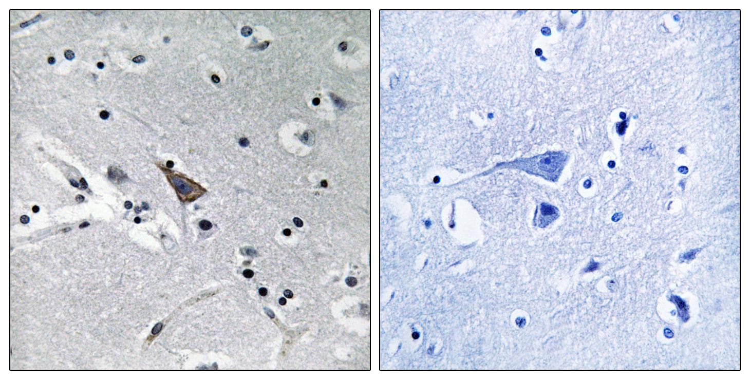 Polyclonal Rabbit anti-Human SLC6A16 Antibody (IHC)