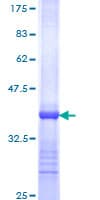 Human ESRRA / ERR Alpha Protein (Recombinant GST, N-terminus)