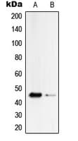 Polyclonal Rabbit anti-Human SERPINB4 / SCCA1+2 Antibody (Internal, WB)