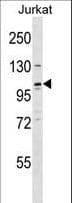 Polyclonal Rabbit anti-Human NRSF / REST Antibody (aa542-570, WB)
