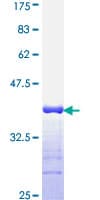 Human IL-1B / IL-1 Beta Protein (Recombinant GST, N-terminus)