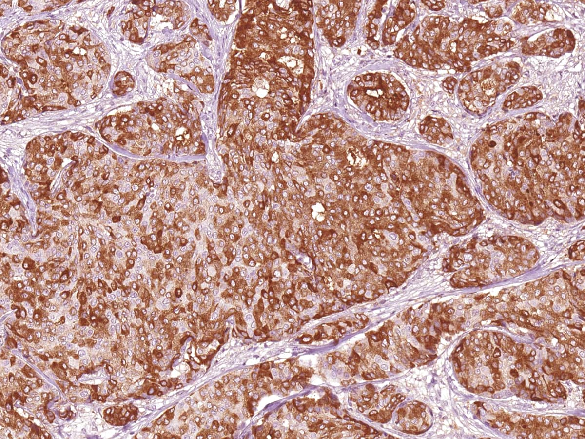 EMA / MUC1 Antibody (Ready-to-Use)
