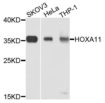 Polyclonal Rabbit anti-Human HOXA11 Antibody (WB)